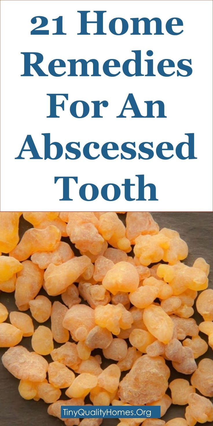 Featured image of post Home Remedies Abscess Tooth Swollen Face Pictures