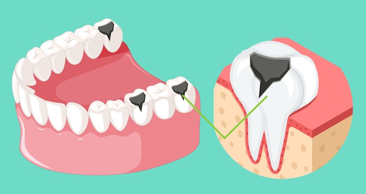 Featured image of post Remedies Abscess Tooth Swollen Face Pictures