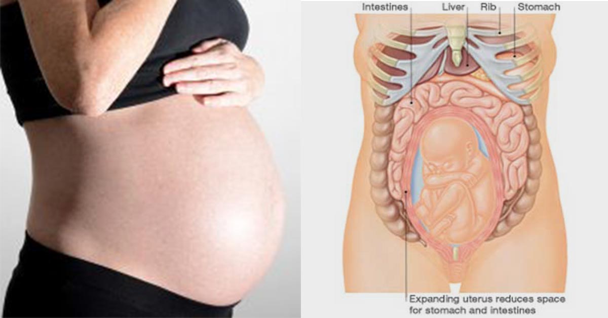Featured image of post What Causes Rib Pain During Pregnancy